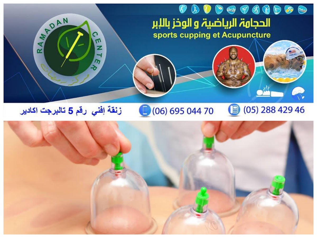 الحجامة الحجامة الطبية al hijama hijama